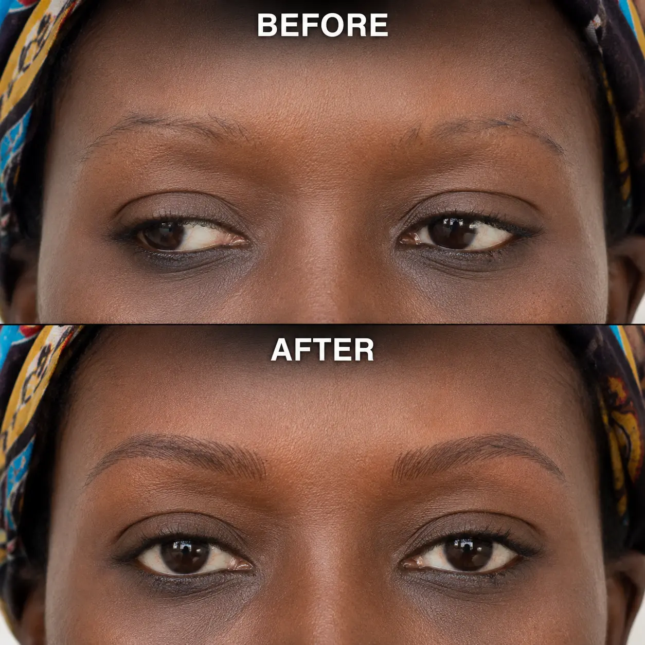 Before and after brow restoration result at Melody Brows