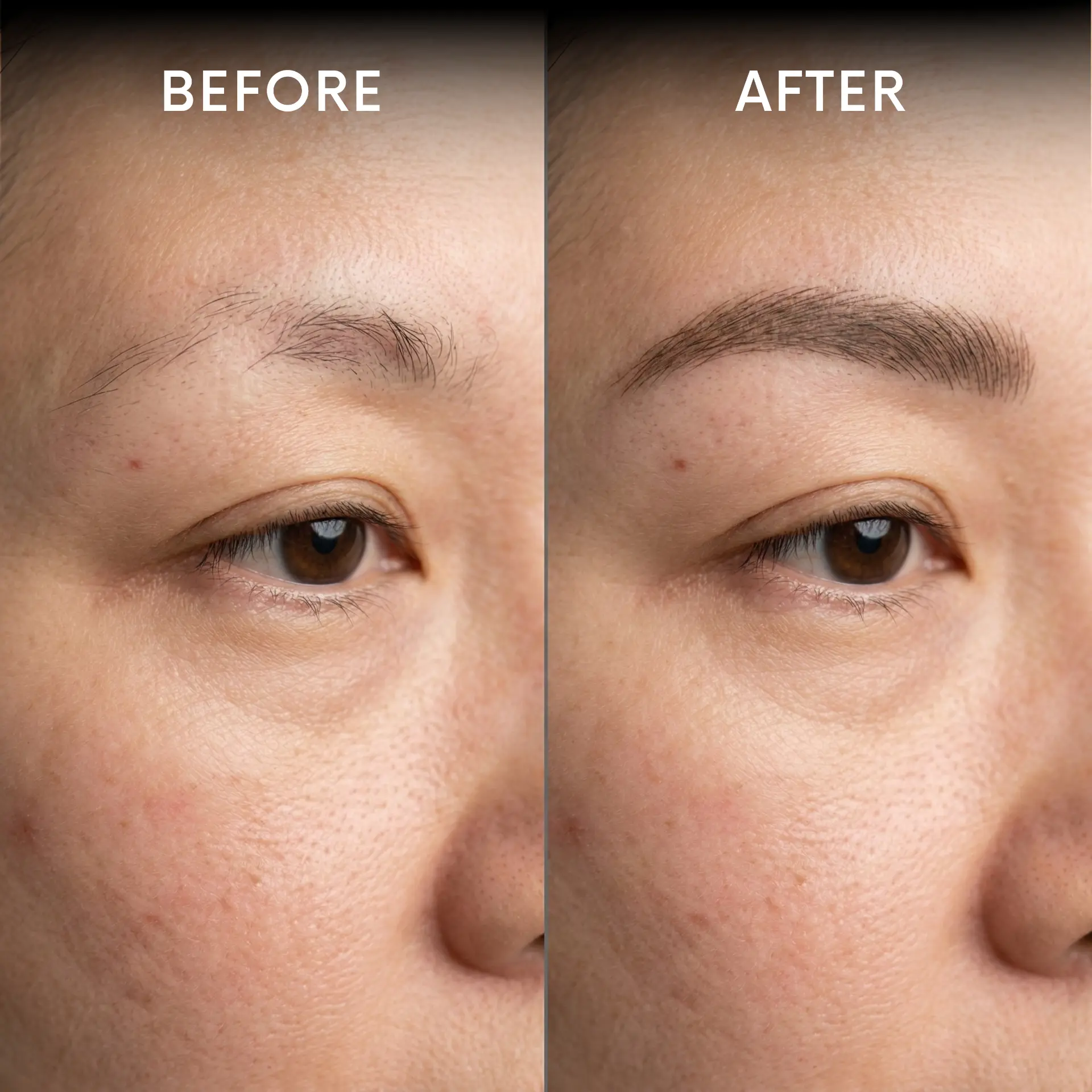 Before and after brow restoration result at Melody Brows